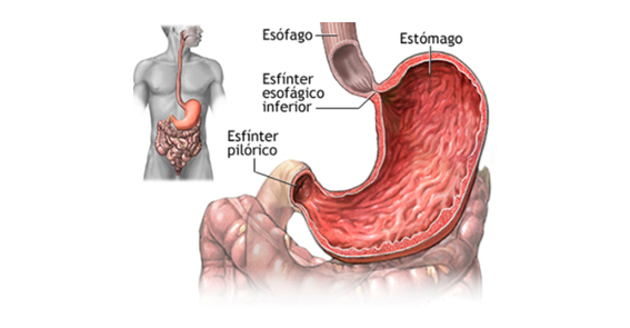 Estenose Hipertrófica Congênita de Piloro - Laparoscopia infantil