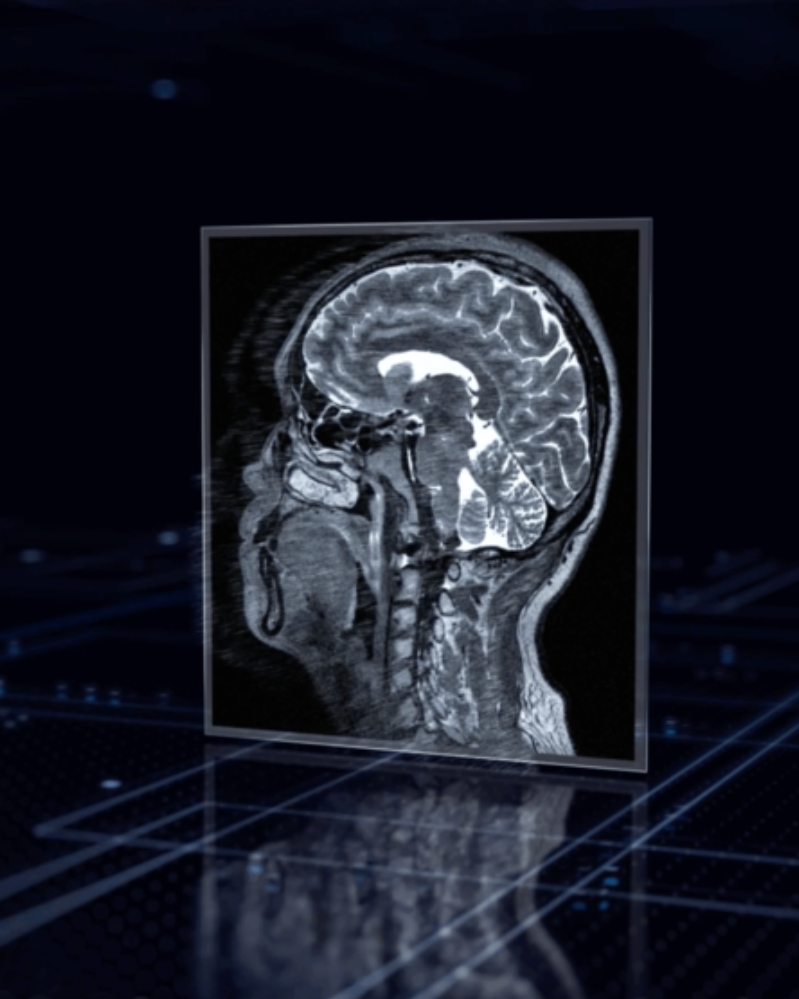 uAid Chest X-ray – Controle de qualidade assistido por IA